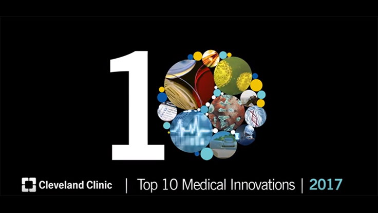 Cleveland Clinic’s Top 10 medical innovations for 2017