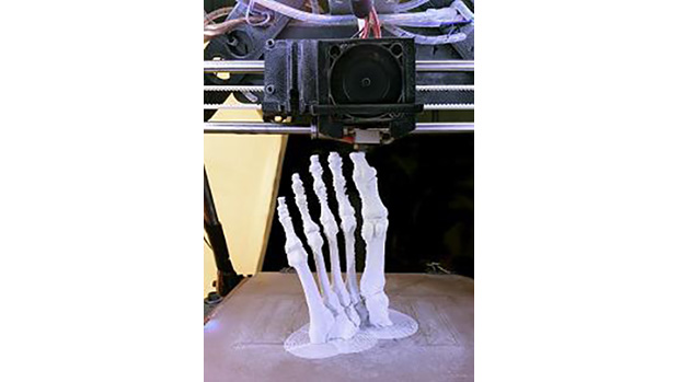 3D printing personalized medical devices