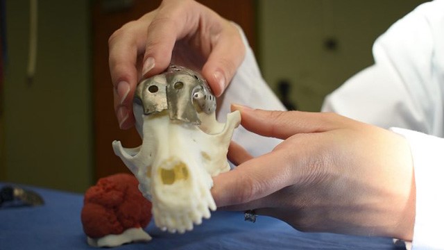 3D printing opens new possibilities for cancer surgeries