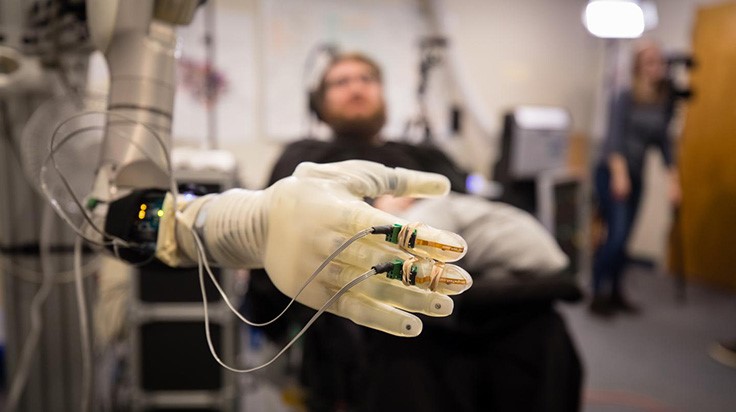 UChicago receives $3.4M NIH grant to develop brain-controlled prosthetic limbs