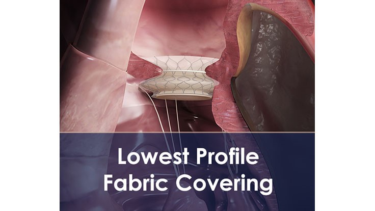 Low-profile medical implant covering
