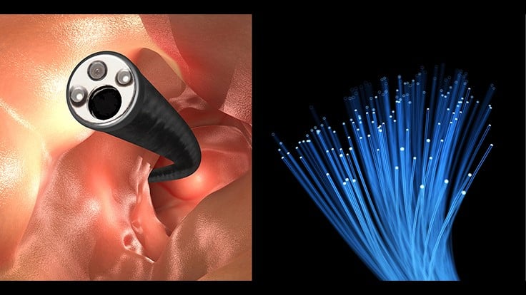 Toray's Raytela polymer optical fiber for minimally invasive surgery.