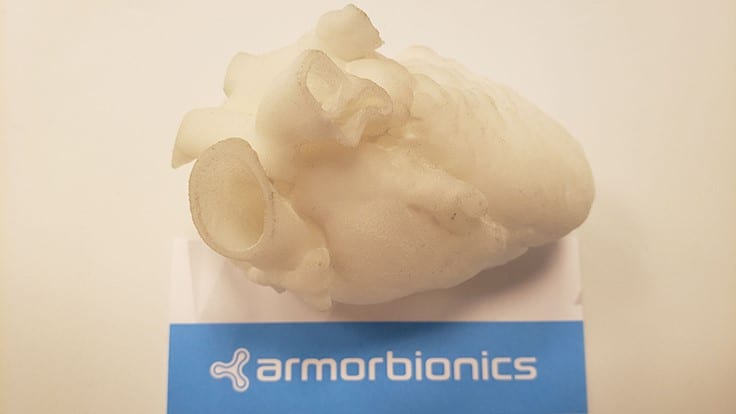 3D-printed infant heart model manufactured for Armor Bionics by Shapeways transforms surgical pre-planning