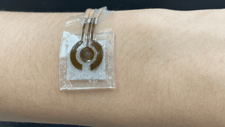 Penn State researchers developed a prototype of a wearable, noninvasive glucose sensor, shown here on the arm.