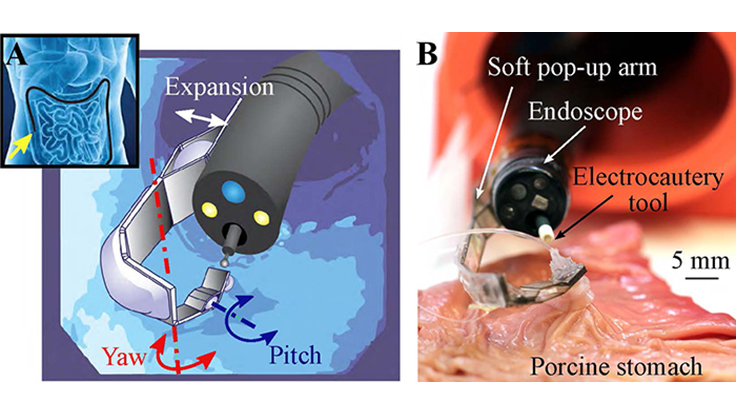 Multi-articulated soft pop-up robotic arm. Concept of the system (left): An endoscope navigating in the GI tract and detail of the arm mounted at the tip of the endoscope. Soft pop-up arm (right) performing tissue counter-traction during an ex-vivo test on a porcine stomach. Image courtesy of Harvard University