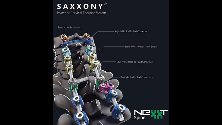 Image courtesy of Nexxt Spine