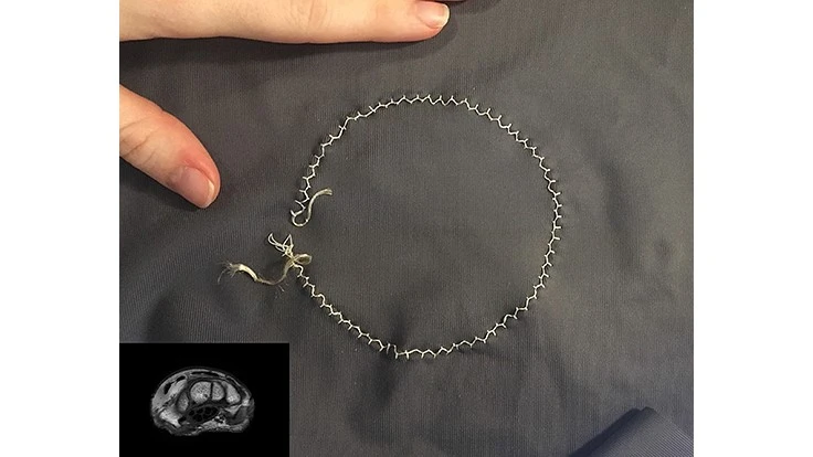 A Purdue University team developed RF coils that are formable and stretchable for medical imaging.