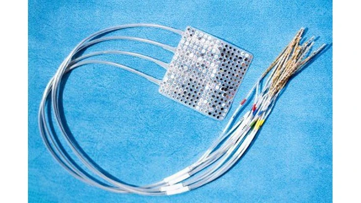 An ECoG array comprises a pad of electrodes that is surgically placed on the surface of the brain. 