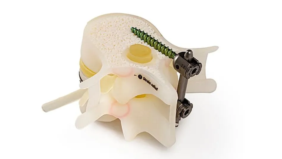  Stratasys Direct collaborates with healthcare and medical device companies to deliver visual and functional anatomical models to improve patient care and outcomes