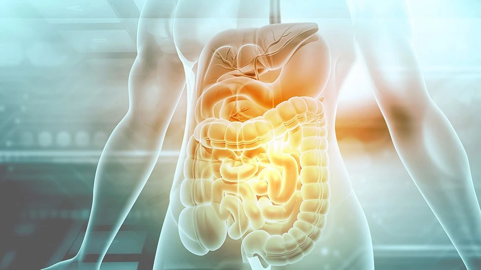 New University of Maryland (UMD) research demonstrates a tiny spring actuator that can anchor a capsule and allow it to deliver a drug deposit to planned locations in the GI tract. With the ability to stay in place for a sustained time, the capsule can deliver multiple doses of medication as needed.