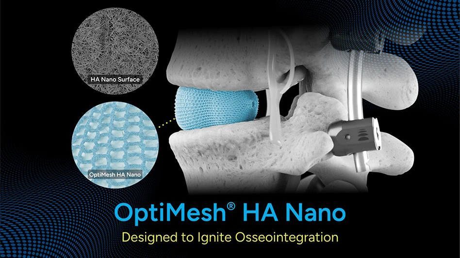 Diagram of a spinal implant with text reading OptiMesh HA Nano Designed to Ignite Osseointegration
